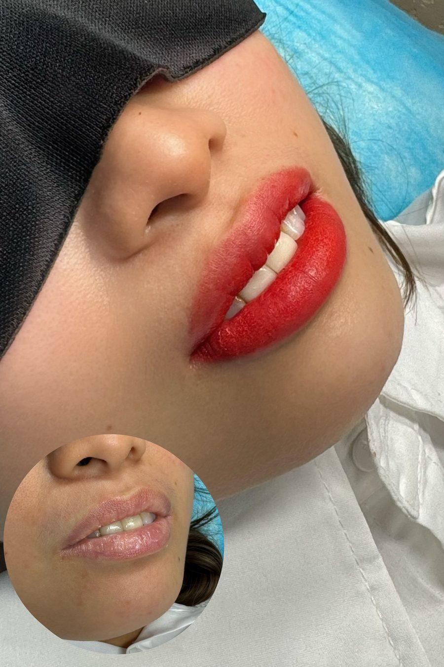 Lip blush on a client, with a smaller photo of the lips inset